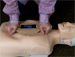 Médico usa iPhone para fazer massagem cardíaca em paciente